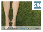 Las V&aacute;rices, Recomendaciones para mejorar la circulaci&oacute;n venosa en solucionmedica.com.mx