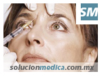 Aplicación de botox en arrugas en cejas frente contorno de ojos. www.solucionmedica.com.mx