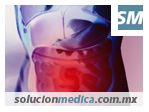 Colitis o Colon Irritable. tratamiento nutricional para mejorar la digesti&oacute;n | www.solucionmedica.com.mx. Tu directorio de salud y belleza en la red M&eacute;xico.