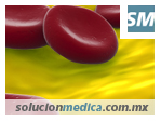 ¿Por que es importante conocer los niveles de colesterol? solucionmedica.com.mx